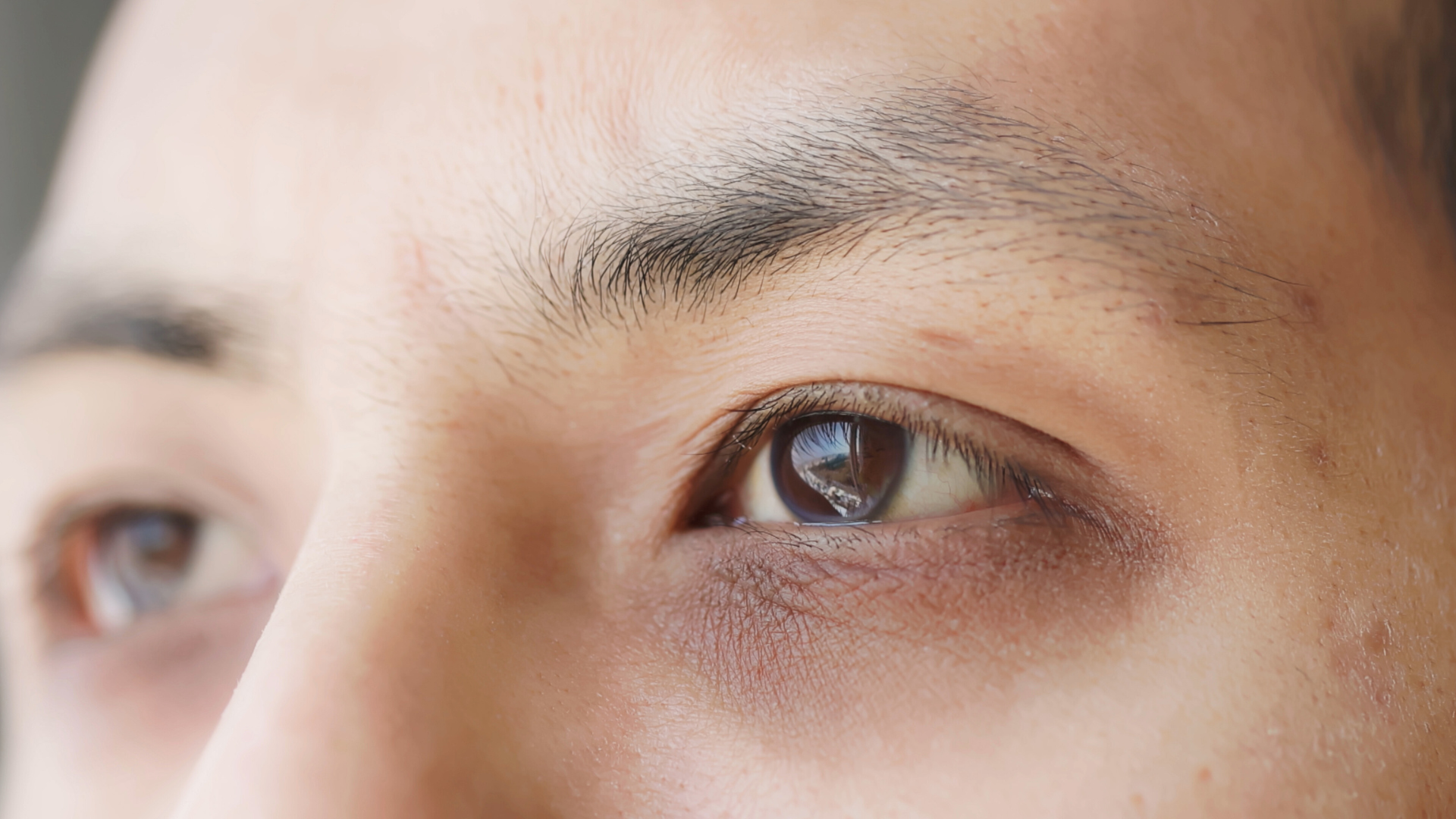 dark circles